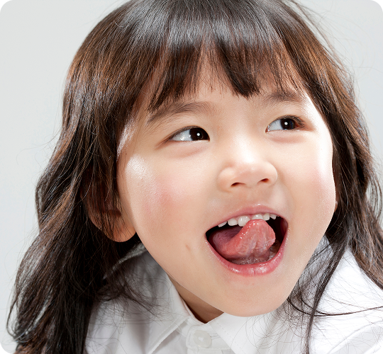 설소대 단축증(혀유착) 이미지